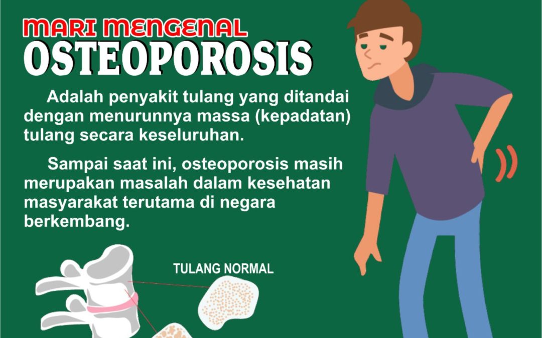 Mari Mengenal Osteoporosis